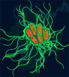 salmonella2304_228x233.jpg