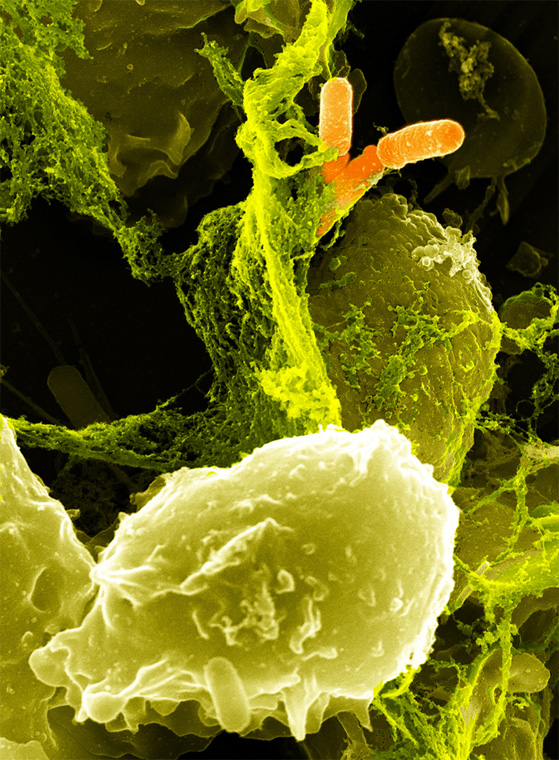 shigella1.jpeg.jpg