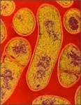 botulism_01