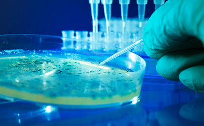 http://www.dreamstime.com/royalty-free-stock-photography-bacterial-colonies-image26741907